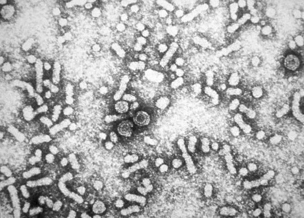 Электронная микрография вирусных частиц гепатита В